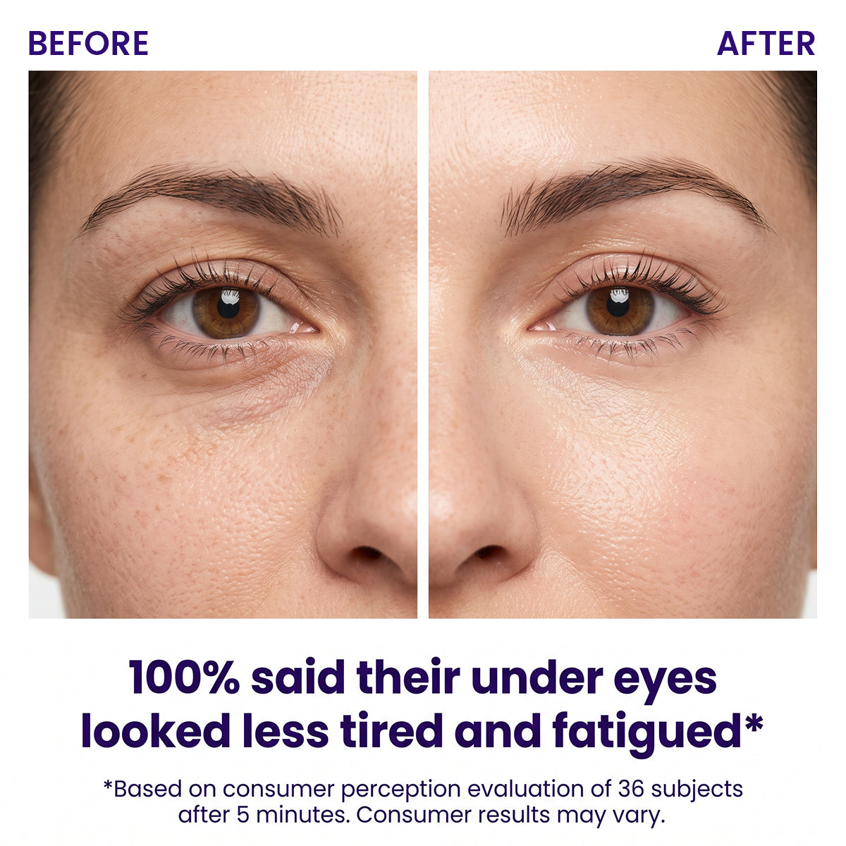 Instant Lift Eye Gel — Reduce the Look of Eye Bags in Minutes 🔥
