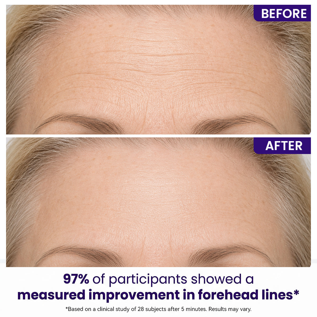 Instant Lift Eye Gel — Reduce the Look of Eye Bags in Minutes 🔥